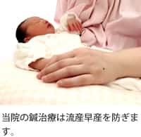 当院の鍼治療は流産早産を防ぎます。